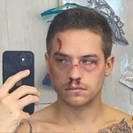 @dylansprouse